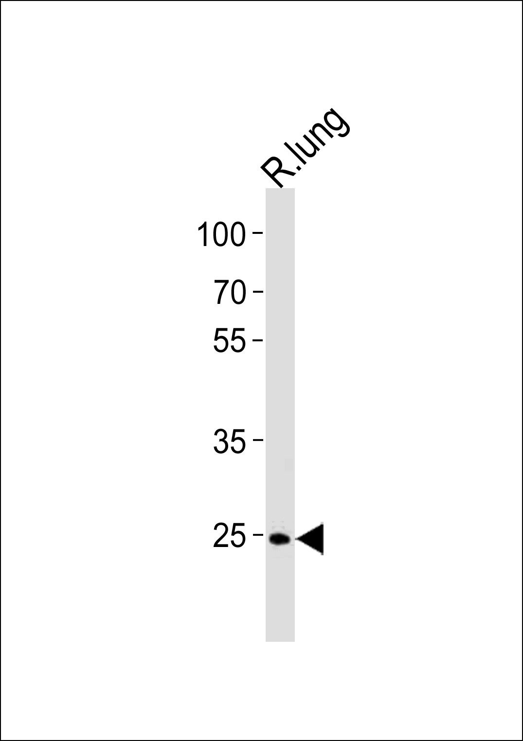 Rabbit Polyclonal Antibody to R Cdk4