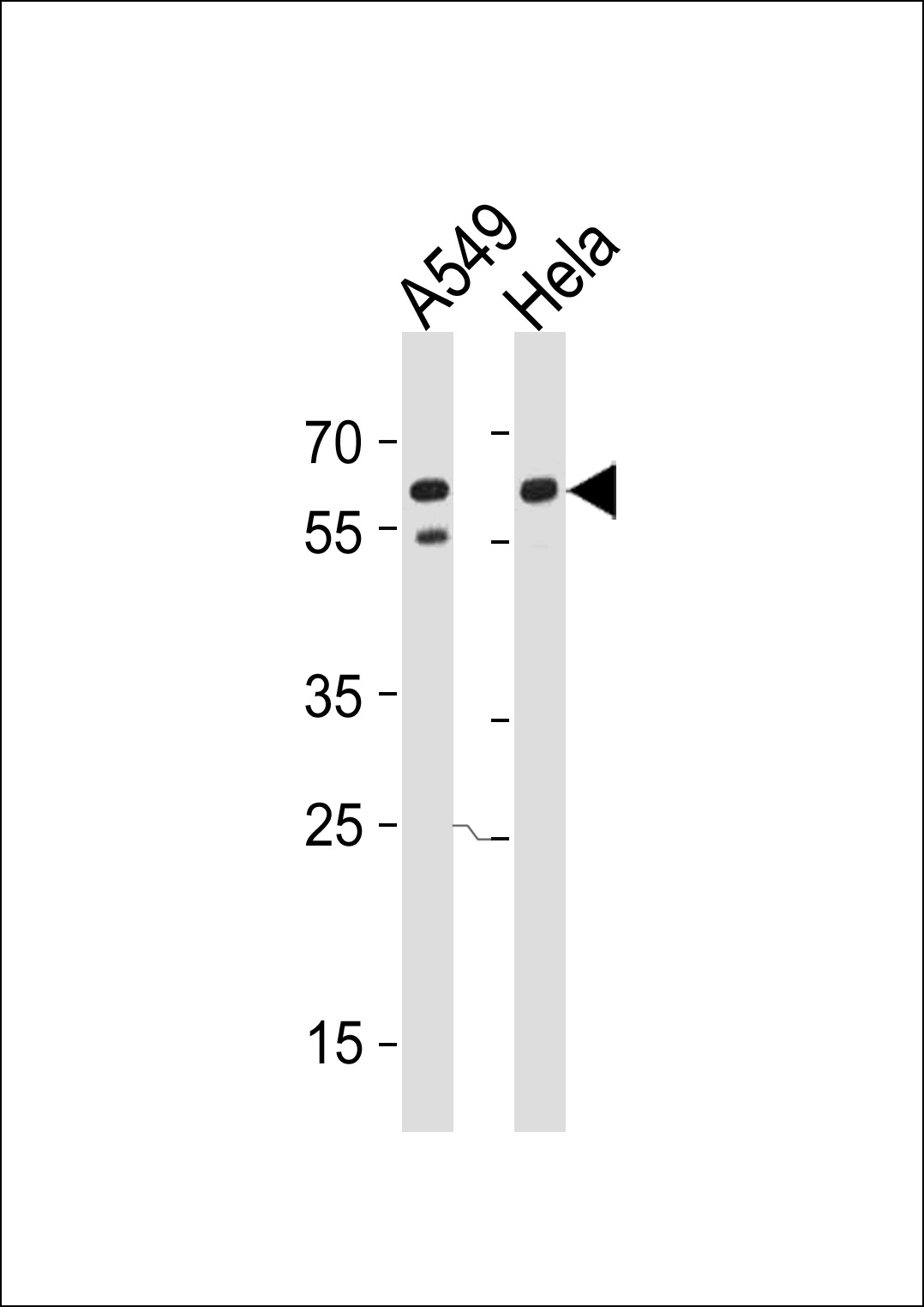Rabbit Polyclonal Antibody to CD46 (Center Y354)
