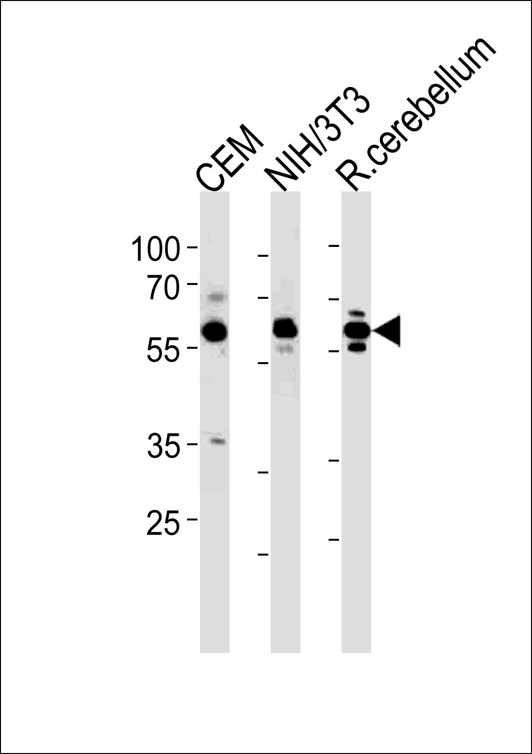 Rabbit Polyclonal Antibody to R Prkaa1 (N-term)