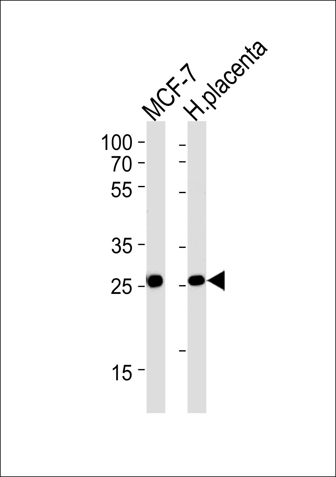 Rabbit Polyclonal Antibody to PRLR
