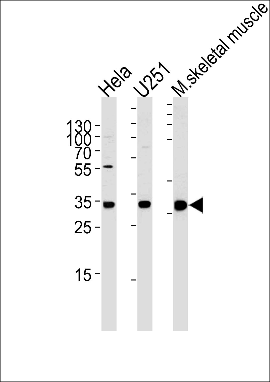 Rabbit Polyclonal Antibody to POLR2C