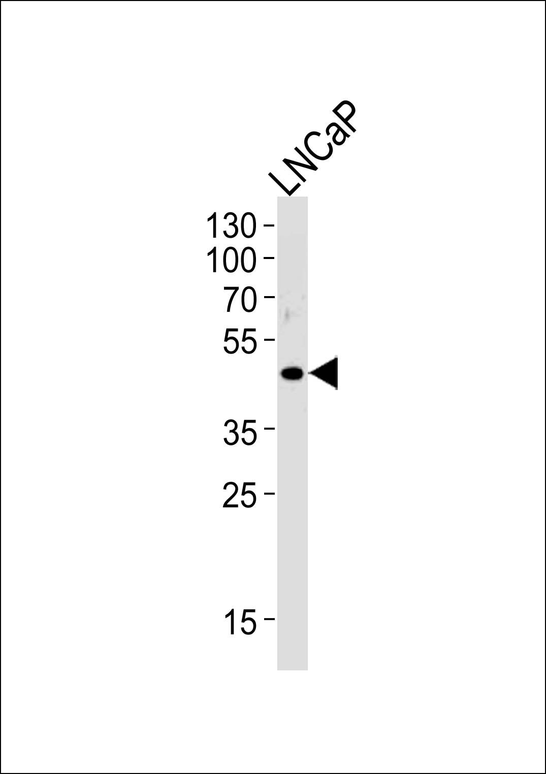 Rabbit Polyclonal Antibody to OR51E1