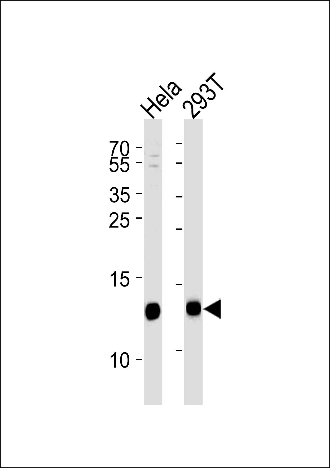 Rabbit Polyclonal Antibody to VAMP8 (N-term)
