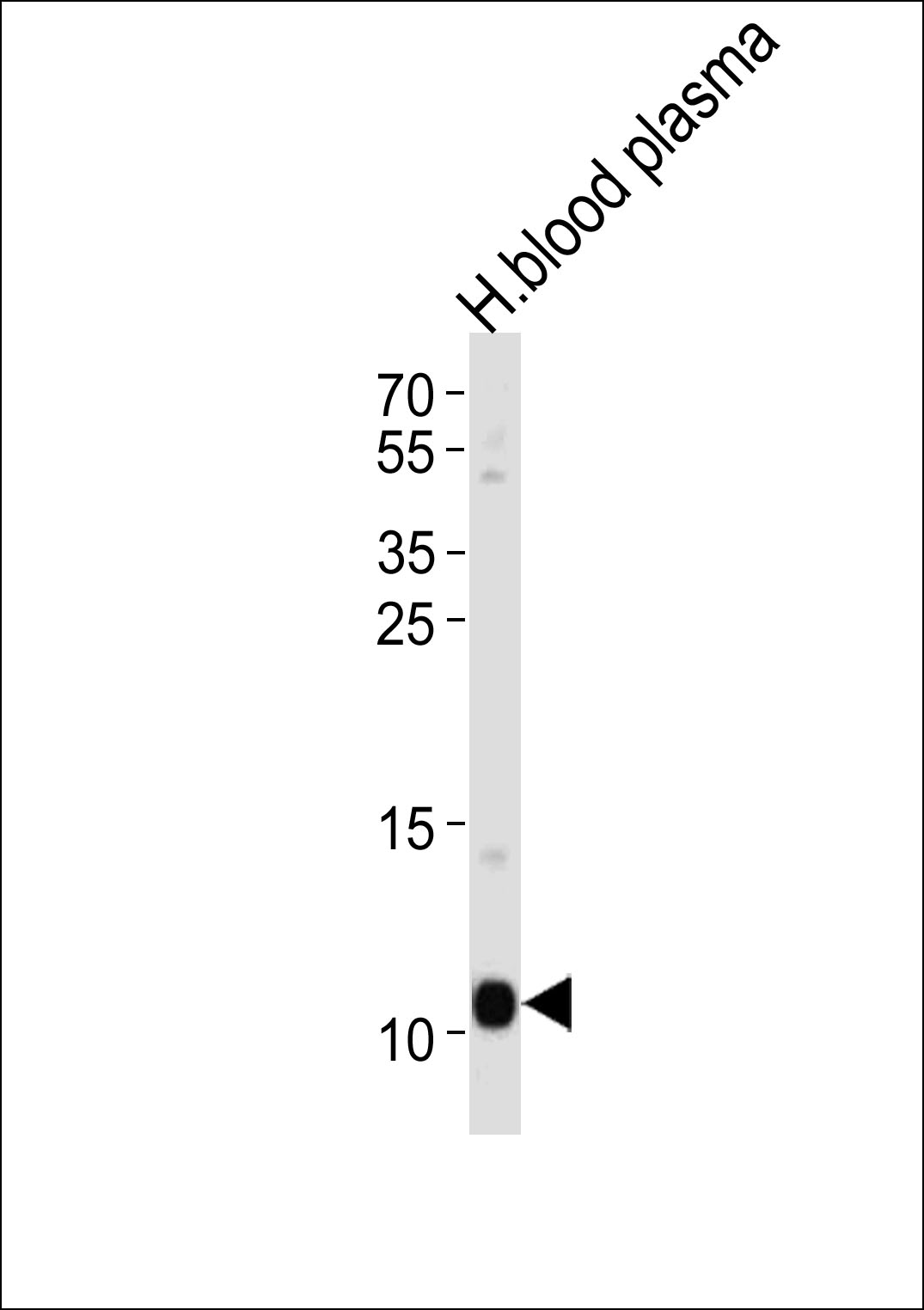 Rabbit Polyclonal Antibody to APOA2