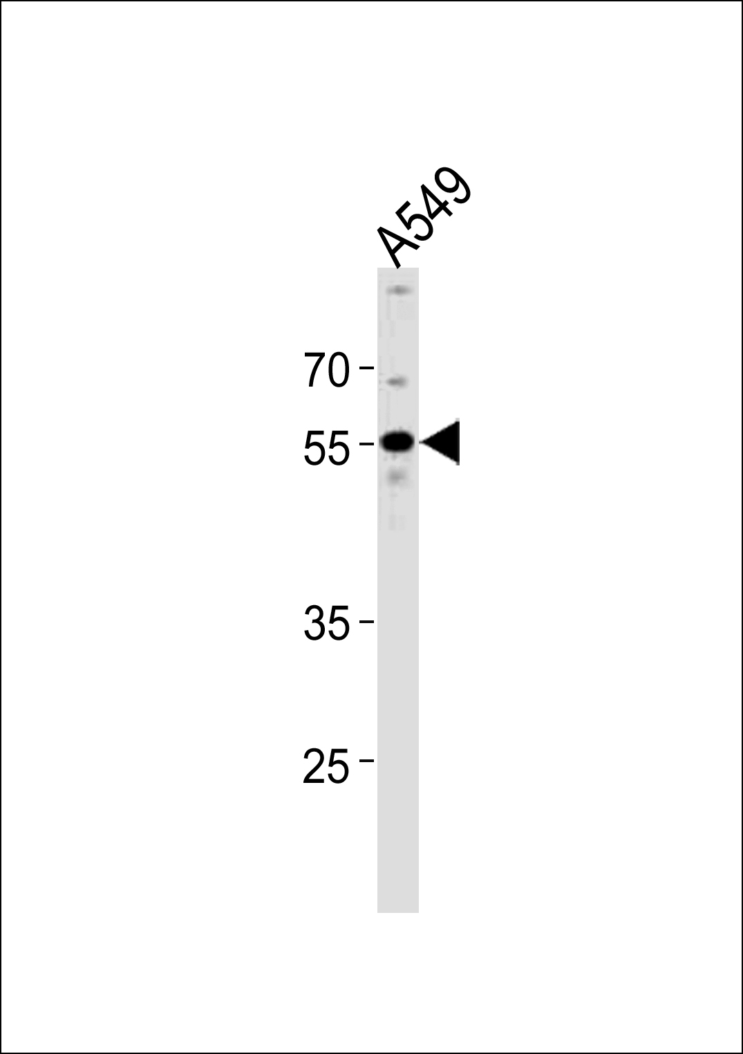 Rabbit Polyclonal Antibody to PPHLN1 (N-term)