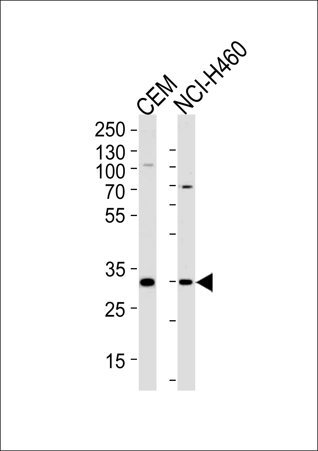 Rabbit Polyclonal Antibody to H2AFY2