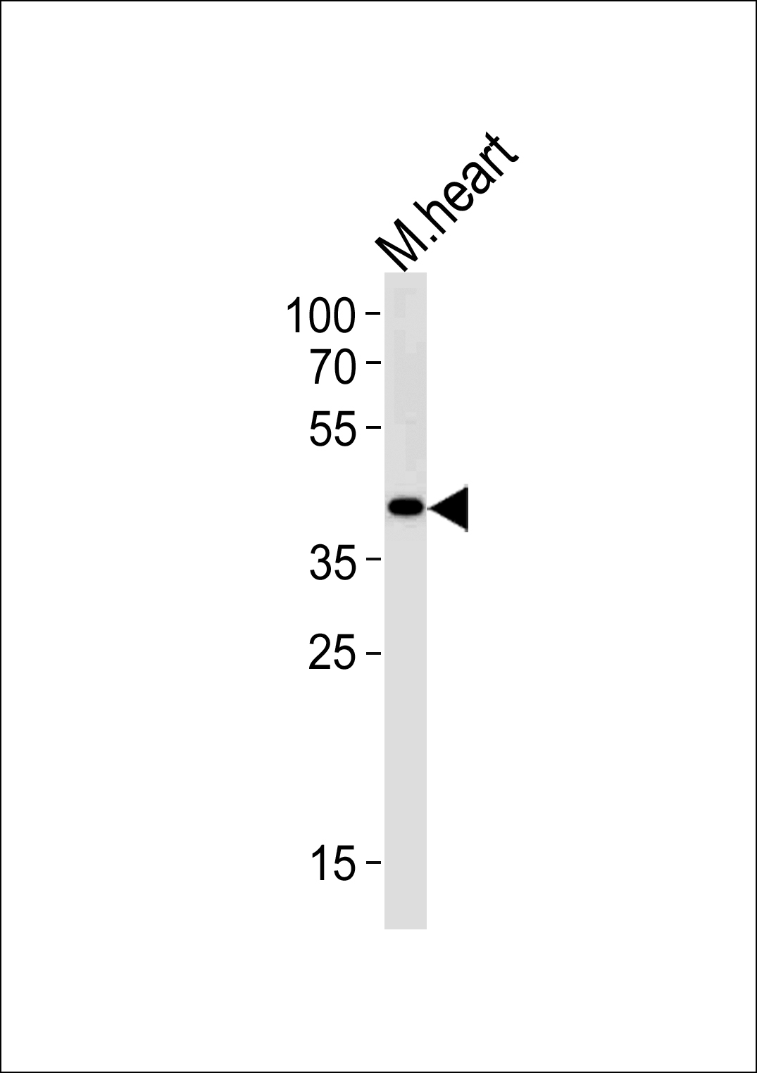 Rabbit Polyclonal Antibody to M Tfap2c (N-term)