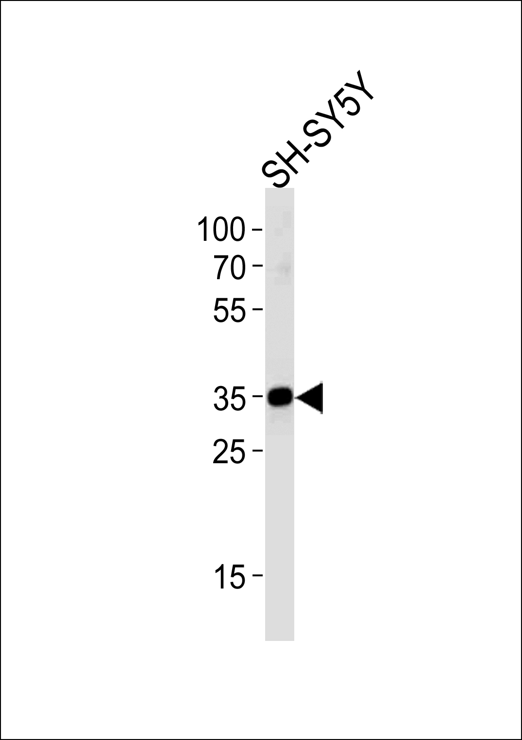 Rabbit Polyclonal Antibody to STX1B (N-term)