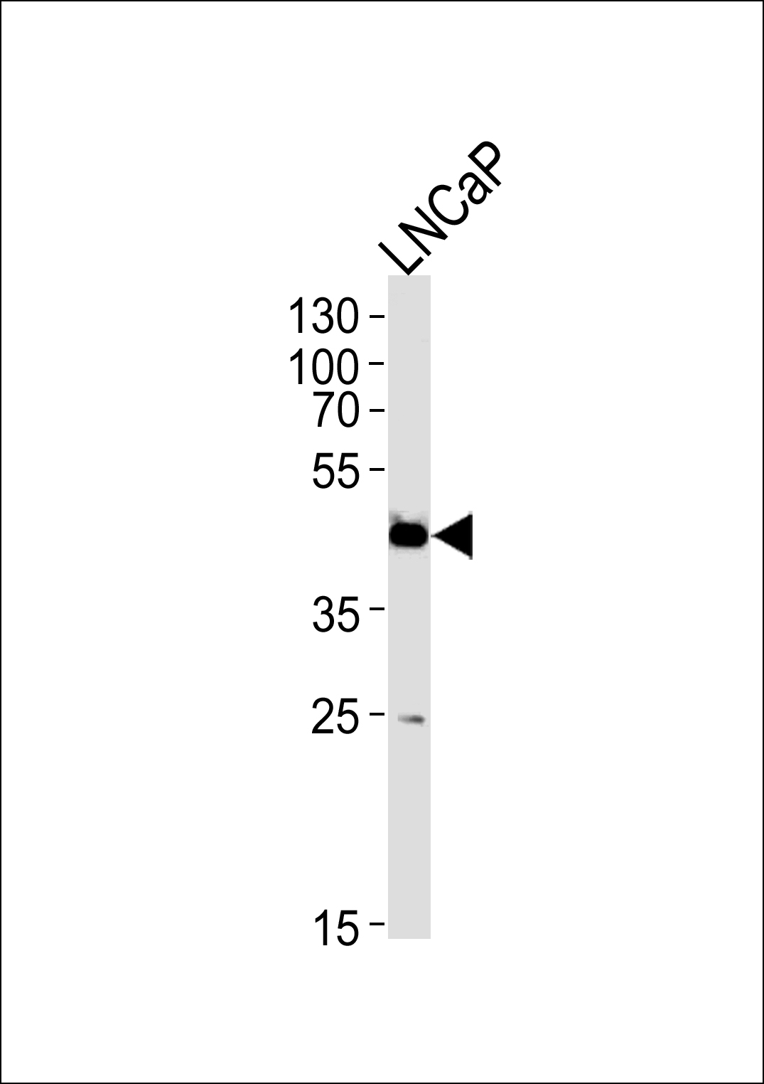 Rabbit Polyclonal Antibody to FAM54A