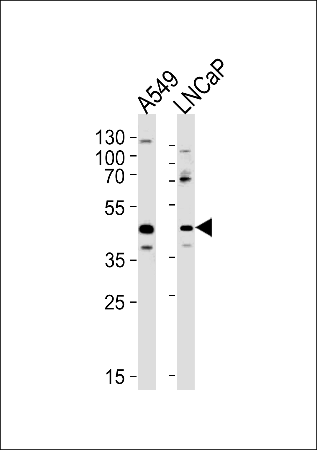 Rabbit Polyclonal Antibody to GGN