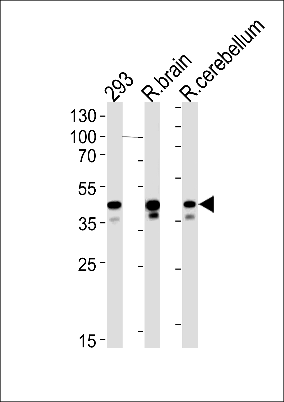 Rabbit Polyclonal Antibody to R Csnk2a1 (N-term)
