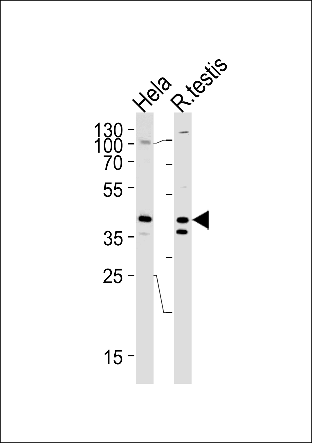 Rabbit Polyclonal Antibody to KHDRBS2