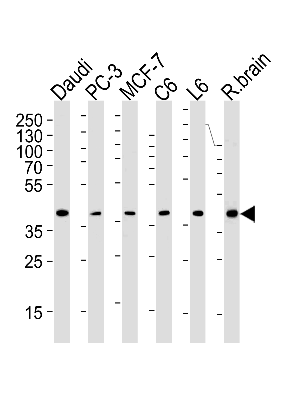 Mouse Monoclonal Antibody to CREB3L4 (M01)