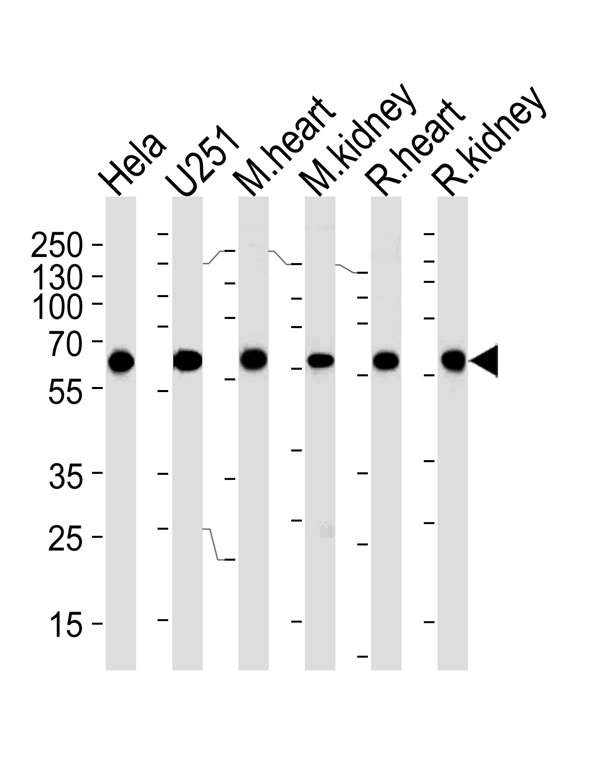 Mouse Monoclonal Antibody to BBS4