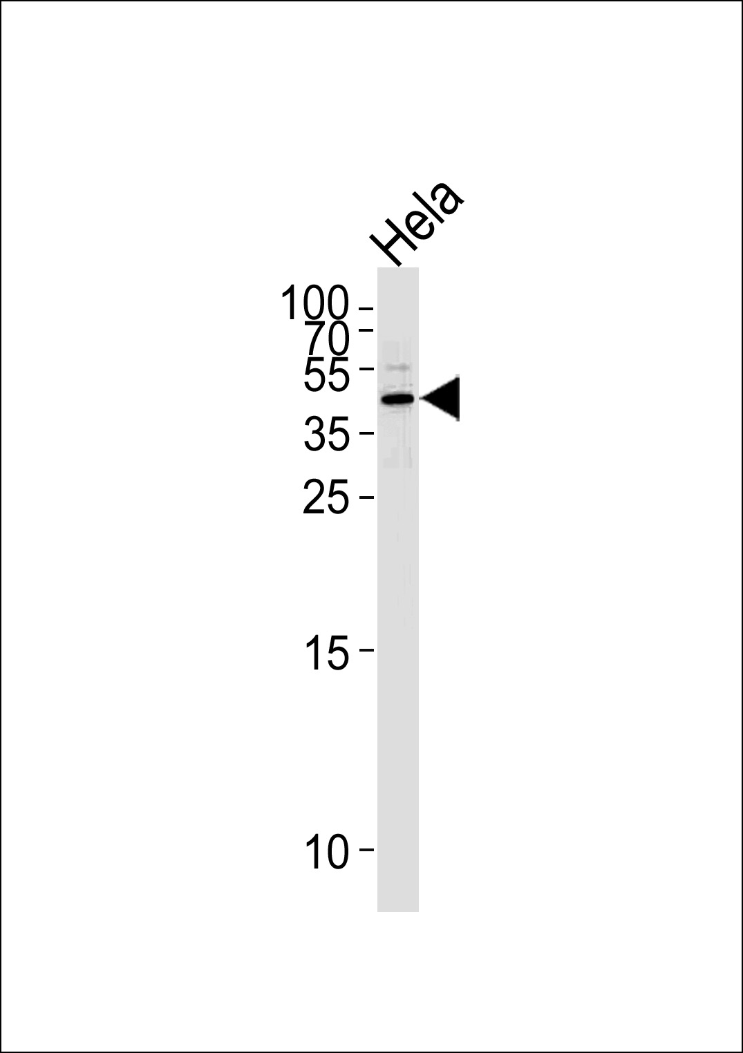 Rabbit Polyclonal Antibody to Maspin