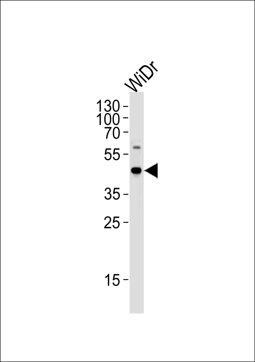Rabbit Polyclonal Antibody to C9orf72