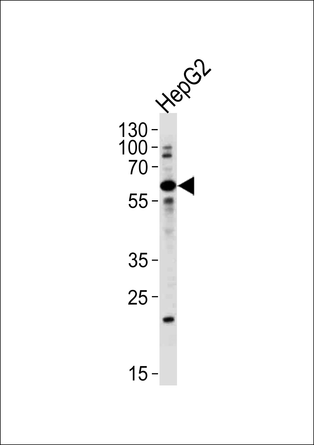 Rabbit Polyclonal Antibody to ZNF192