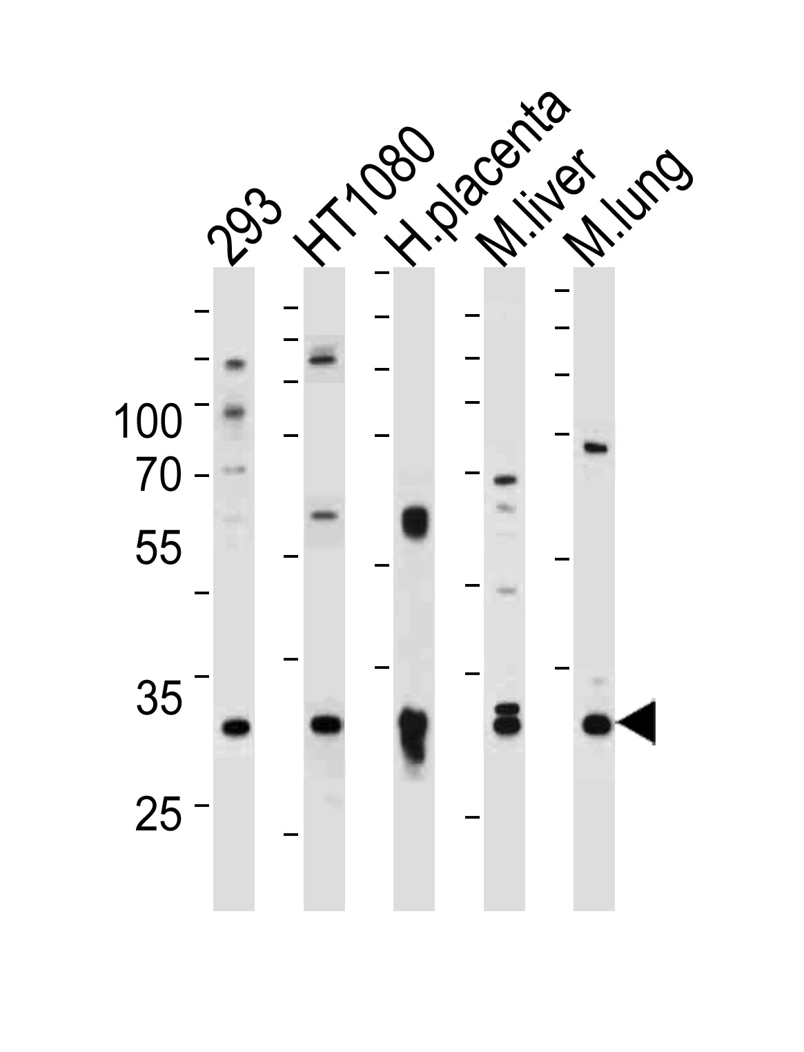 Rabbit Polyclonal Antibody to SAR1A
