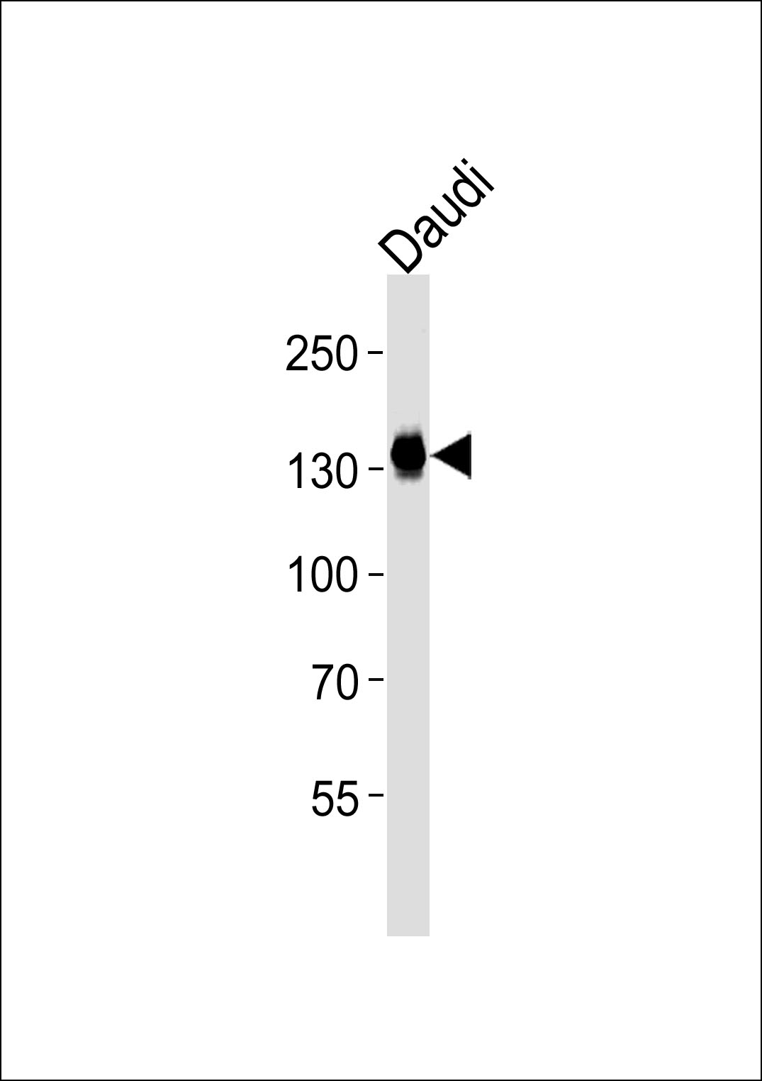 Mouse Monoclonal Antibody to USP25