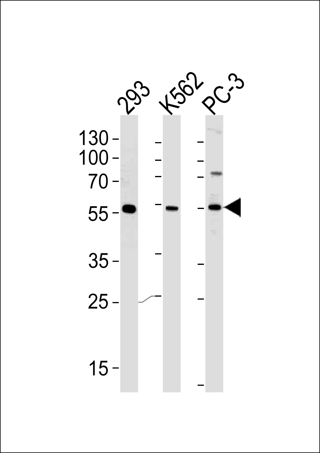 Rabbit Polyclonal Antibody to PIP5KL1 (N-term)