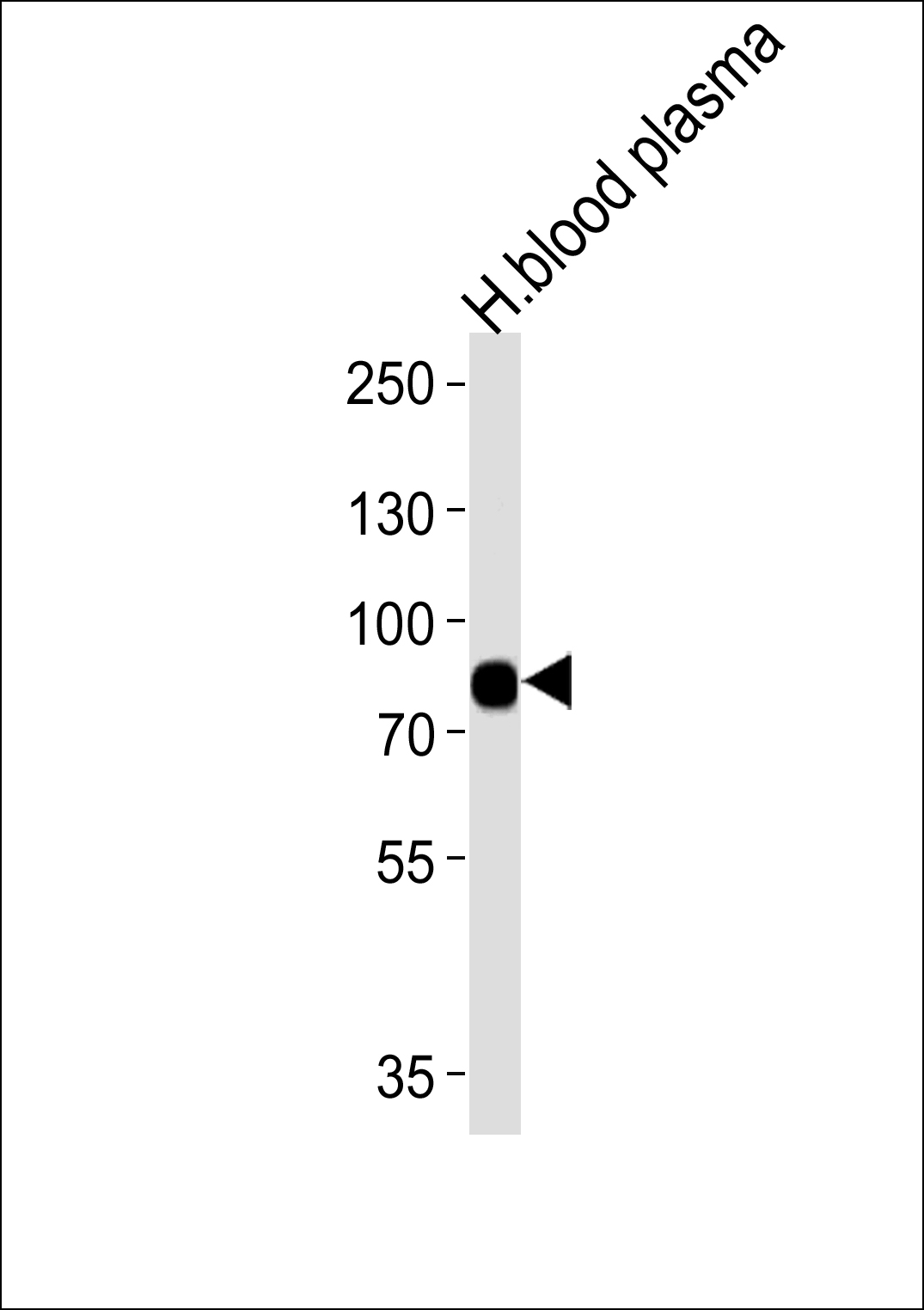 Rabbit Polyclonal Antibody to LRRC45