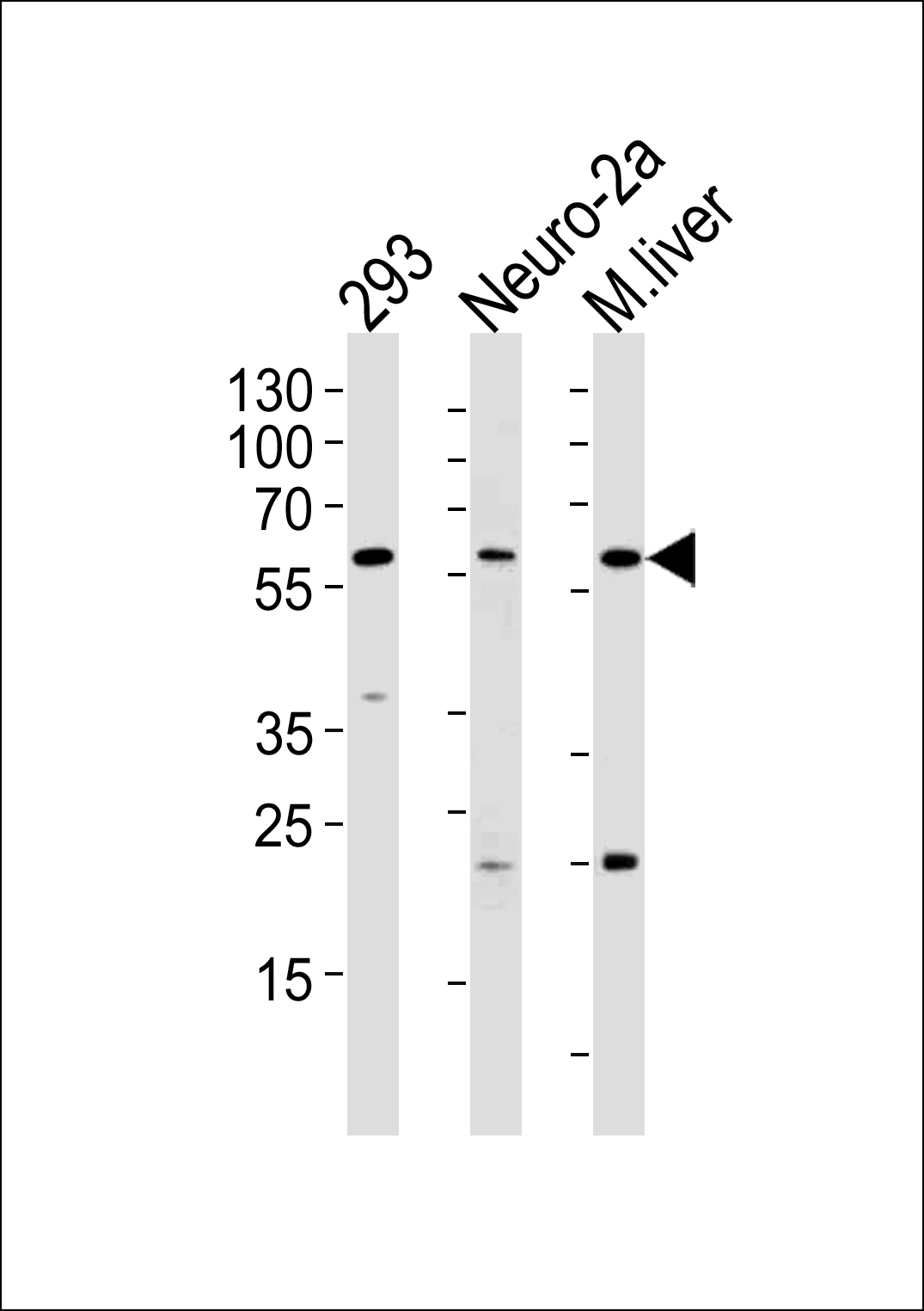 Rabbit Polyclonal Antibody to CCDC36