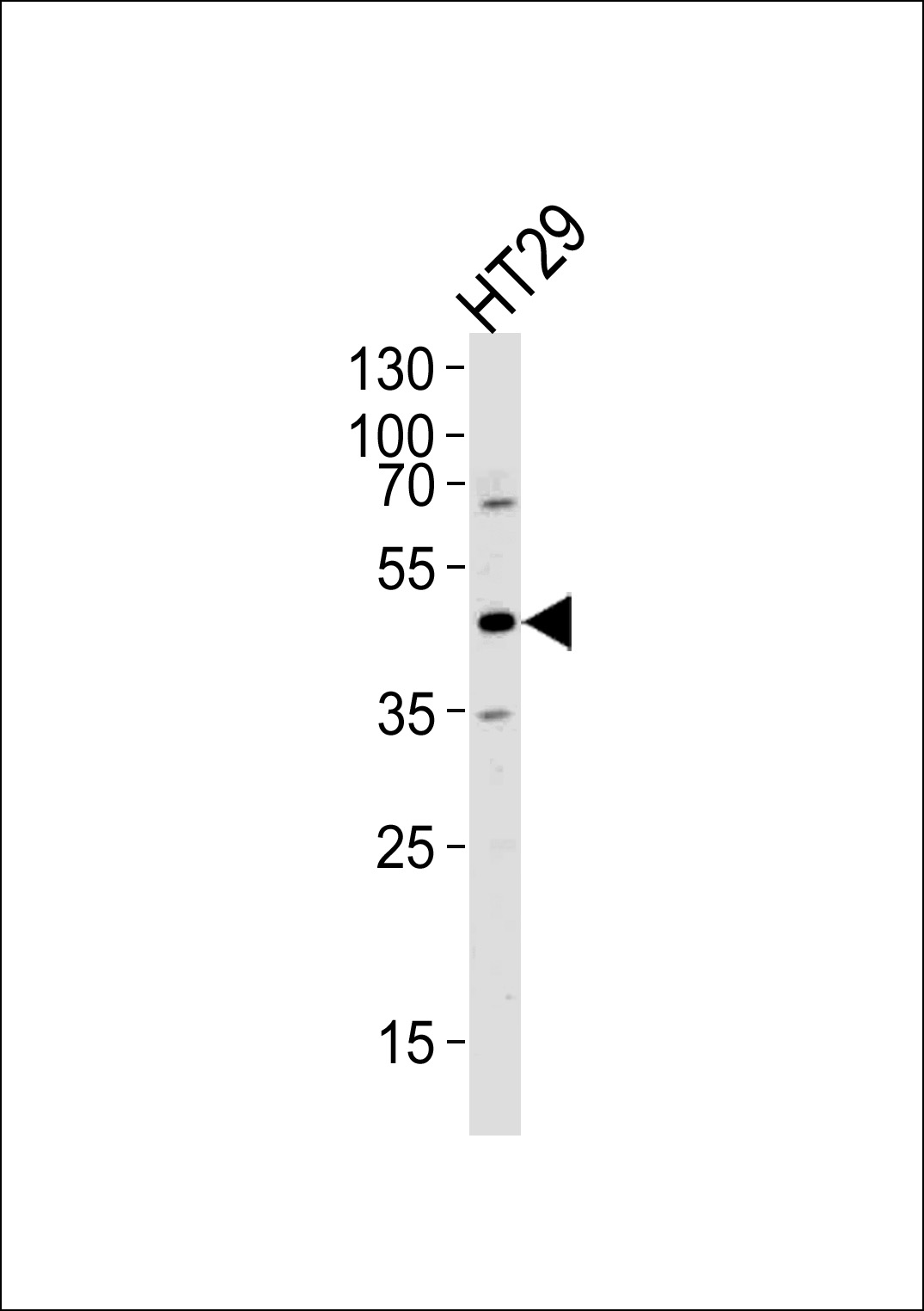 Rabbit Polyclonal Antibody to RNH1