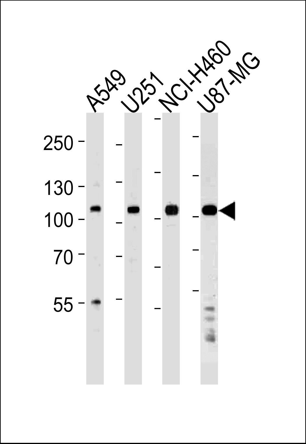 Rabbit Polyclonal Antibody to ZNF41 (N-term)