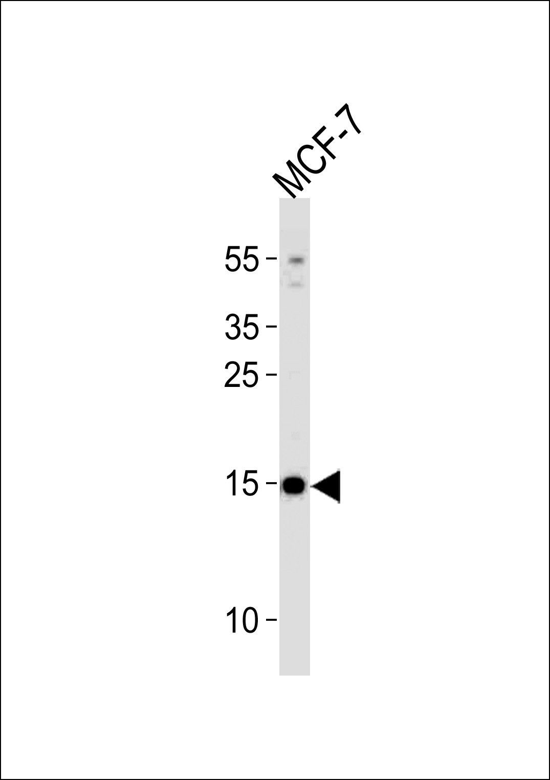 Rabbit Polyclonal Antibody to POLR2J3 (N-term)