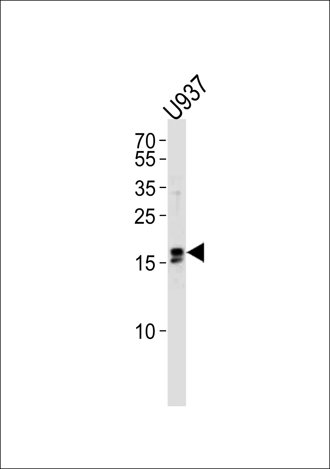 Rabbit Polyclonal Antibody to IQCF6 (N-term)