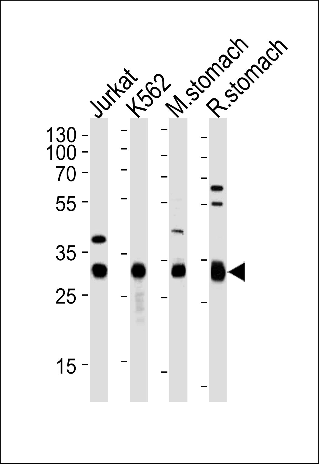 Rabbit Polyclonal Antibody to ESD