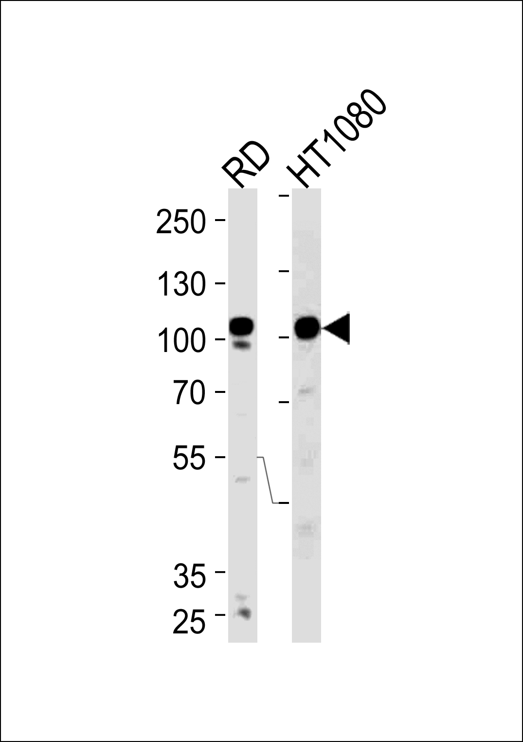 Rabbit Polyclonal Antibody to ATP2A1