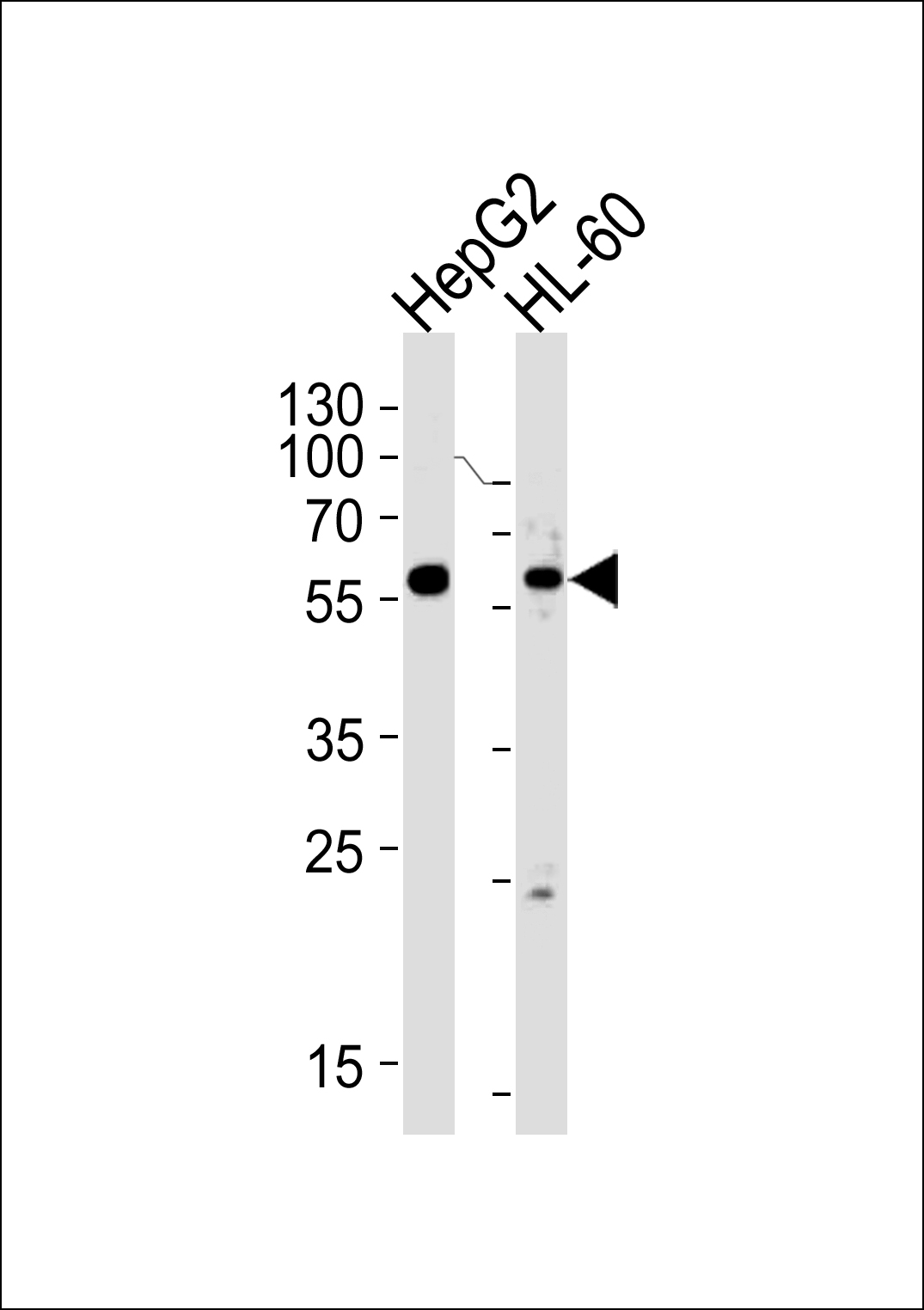 Rabbit Polyclonal Antibody to FANCC