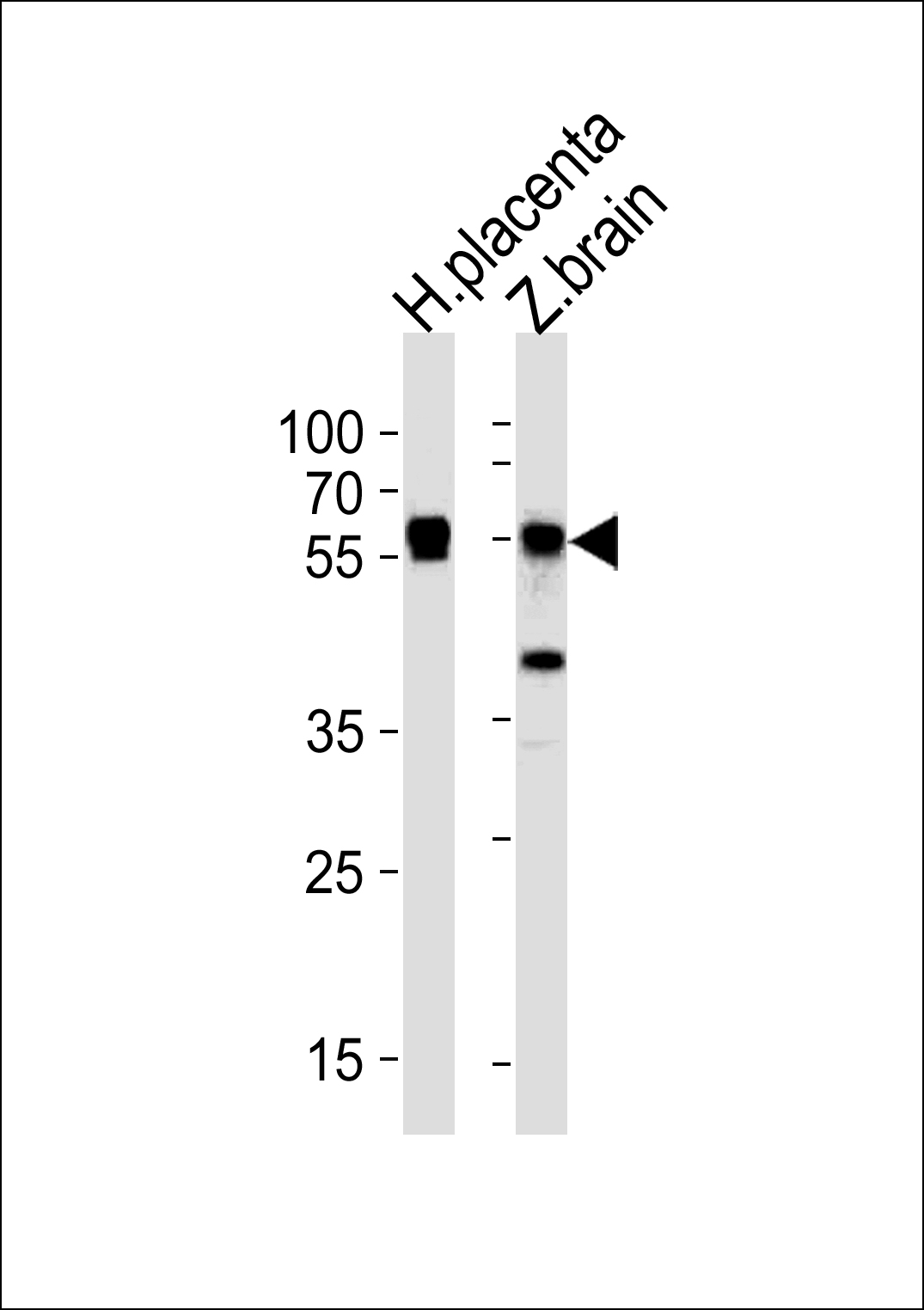Rabbit Polyclonal Antibody to DANRE stk3(36kDa subunit)