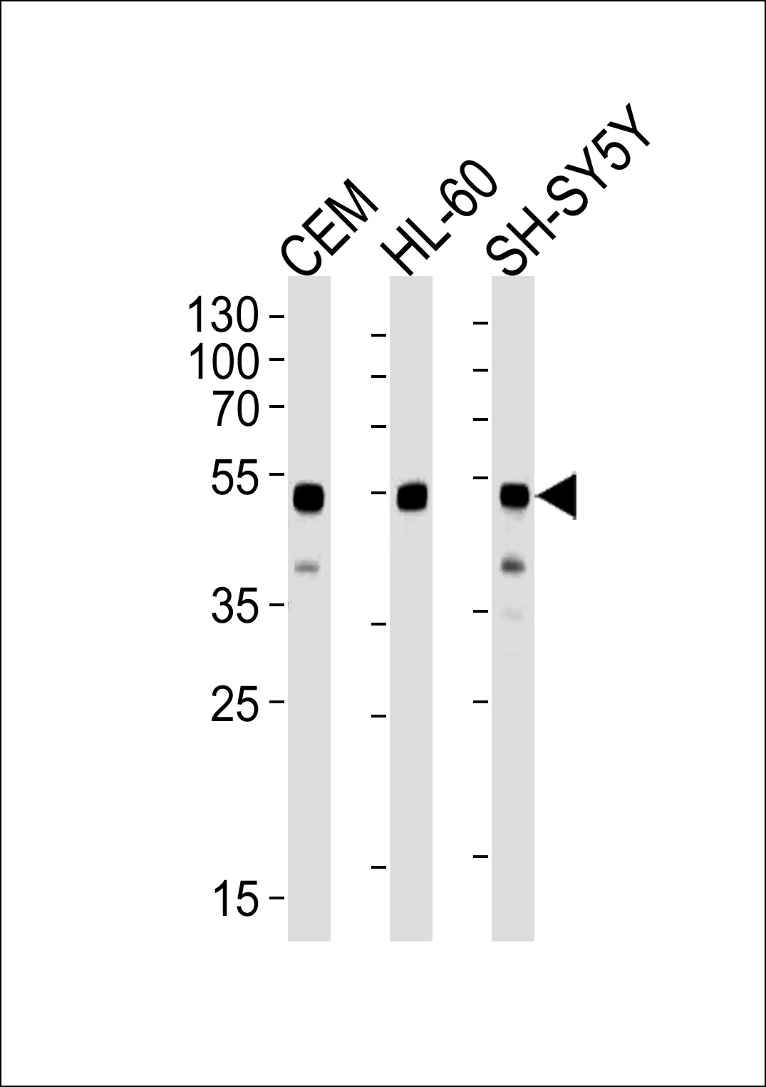 Mouse Monoclonal Antibody to GATA3