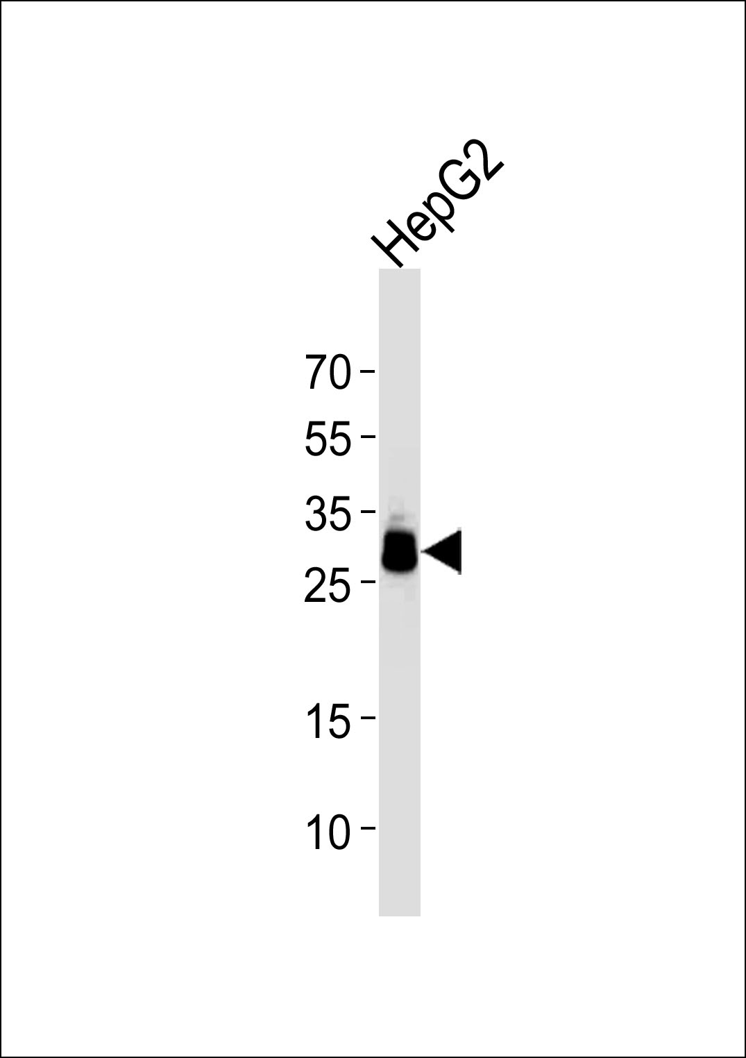Mouse Monoclonal Antibody to PPT1