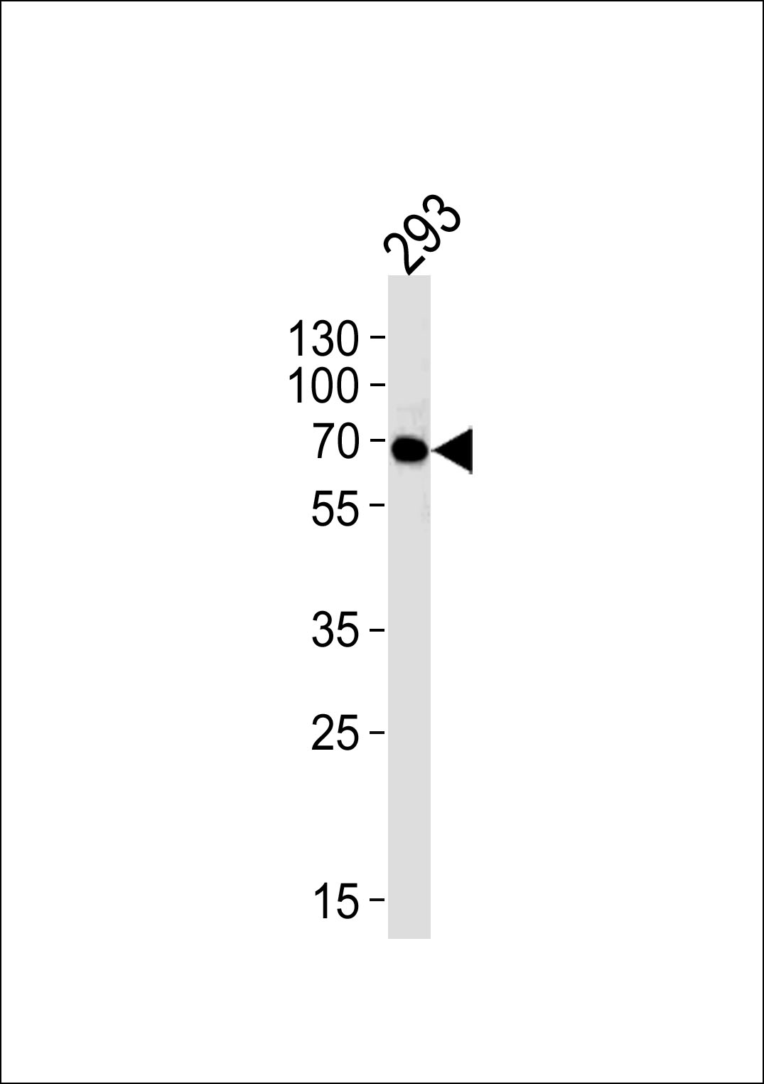 Mouse Monoclonal Antibody to FYN