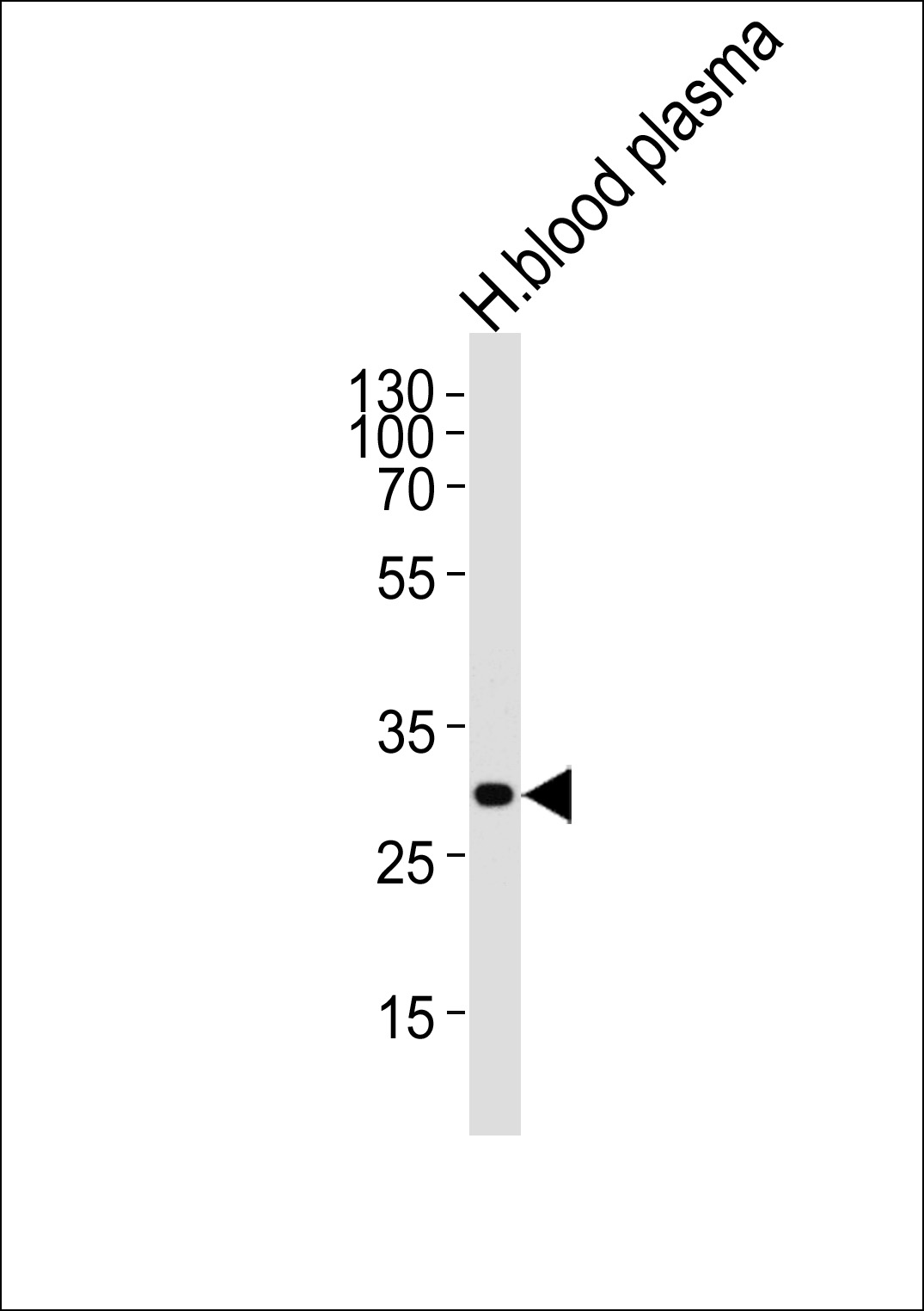 Rabbit Polyclonal Antibody to C1QA