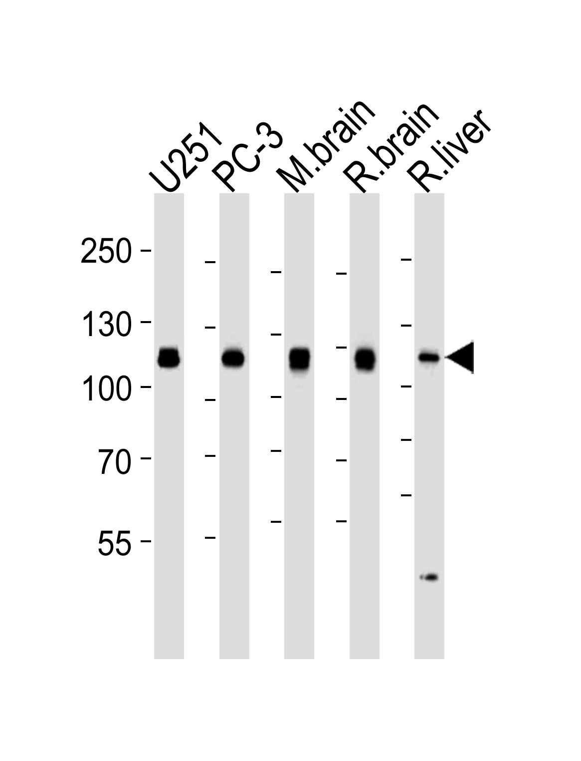 Mouse Monoclonal Antibody to USP5