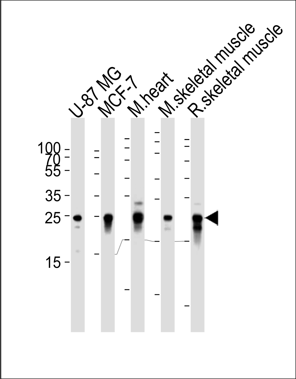 Mouse Monoclonal Antibody to CRYAB