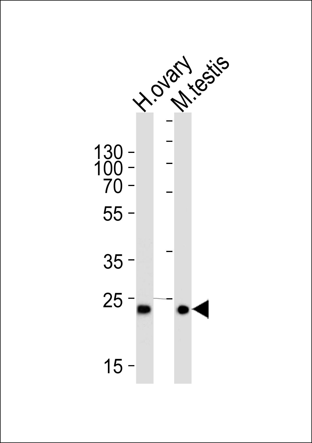 Rabbit Polyclonal Antibody to PLD6