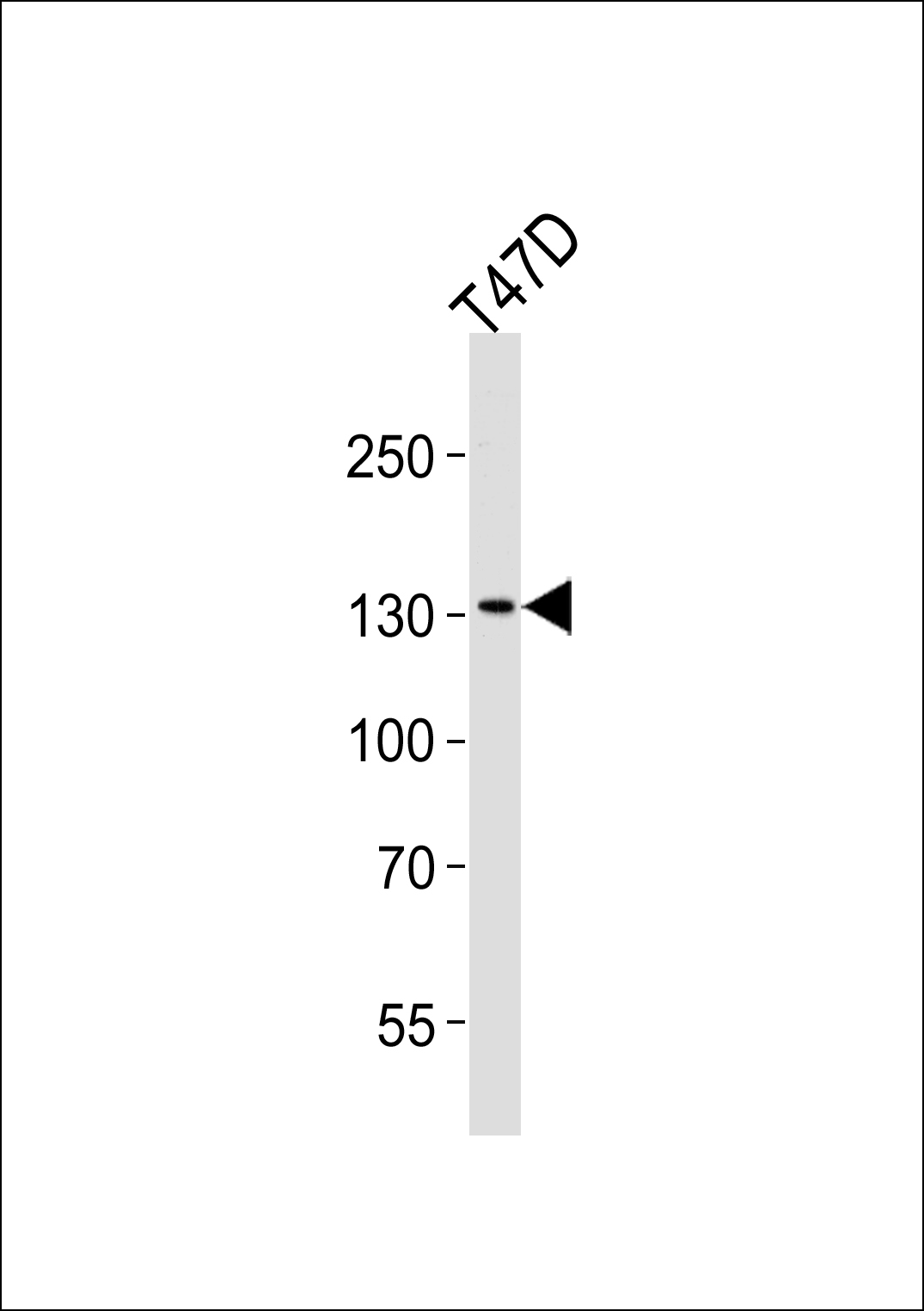 Rabbit Polyclonal Antibody to ATAD2 (N-term)