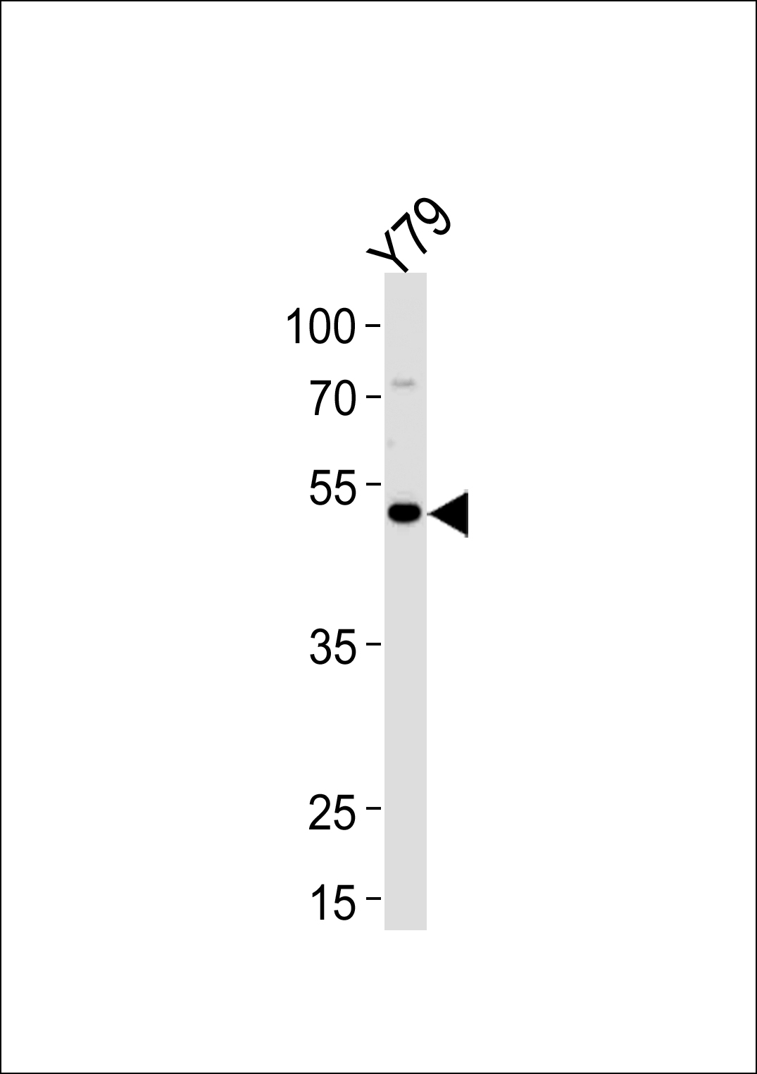 Rabbit Polyclonal Antibody to FOXN4 (N-term)