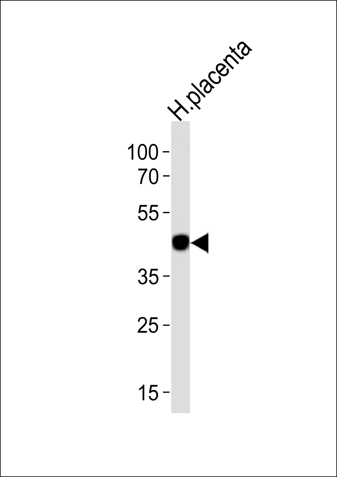 Rabbit Polyclonal Antibody to CIR