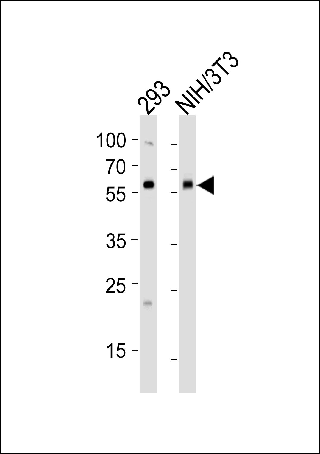 Rabbit Polyclonal Antibody to BMPR1A