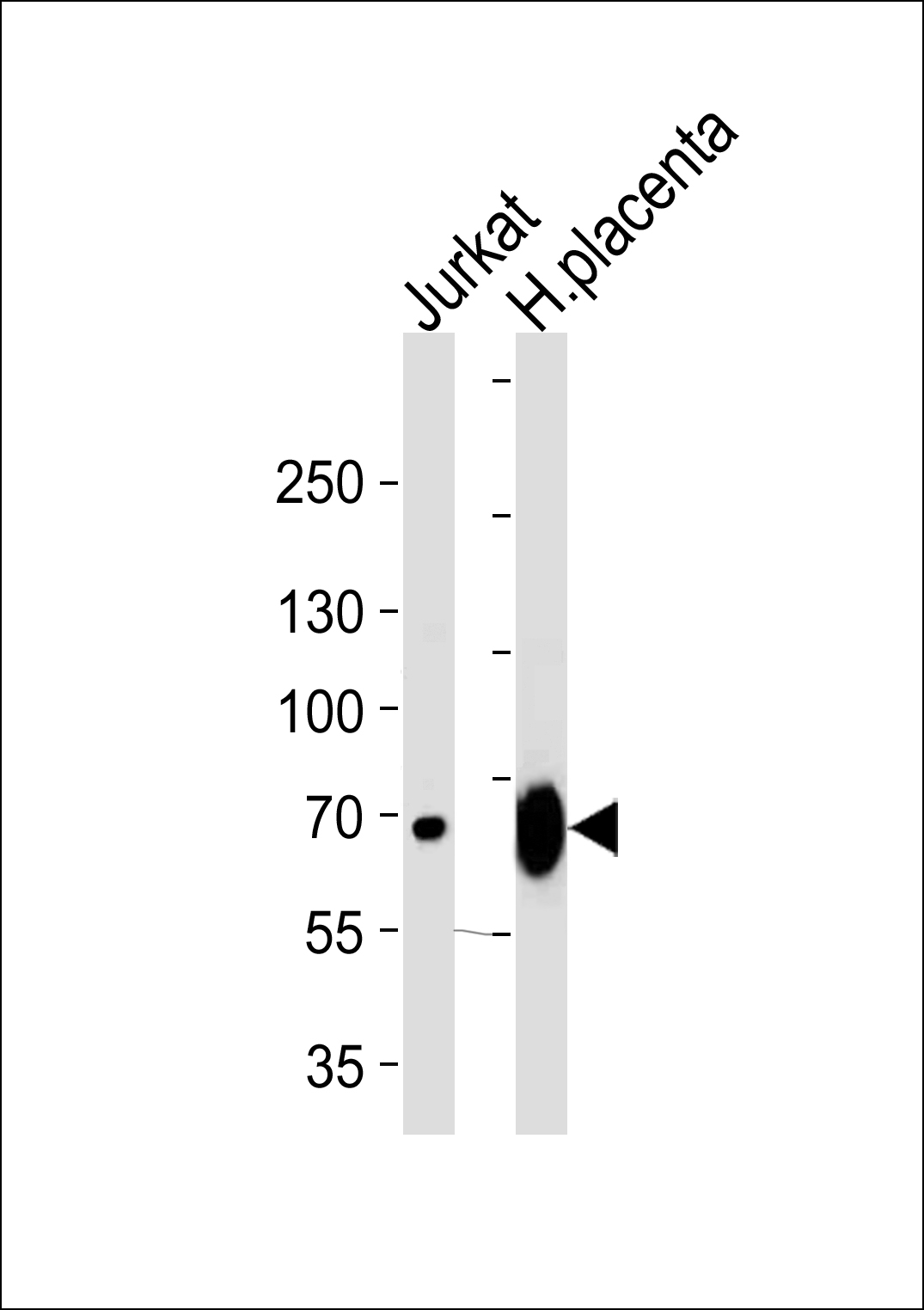 Rabbit Polyclonal Antibody to LIMK2