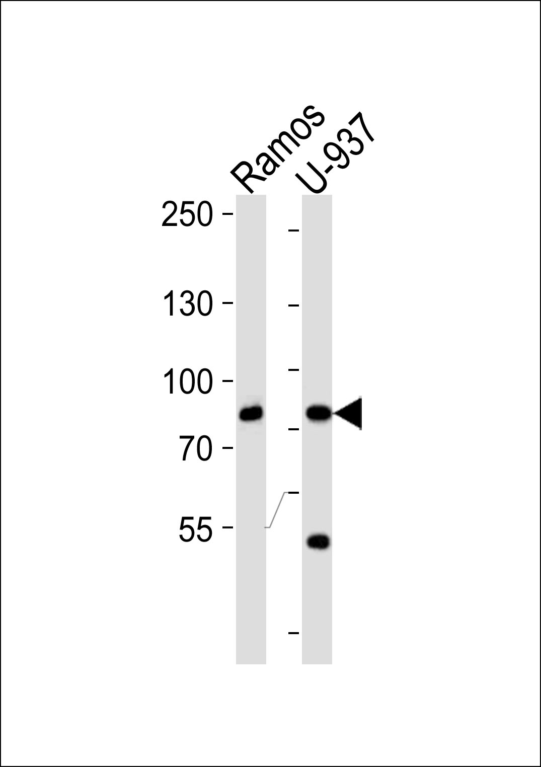 Rabbit Polyclonal Antibody to ZC3H11A (N-term)