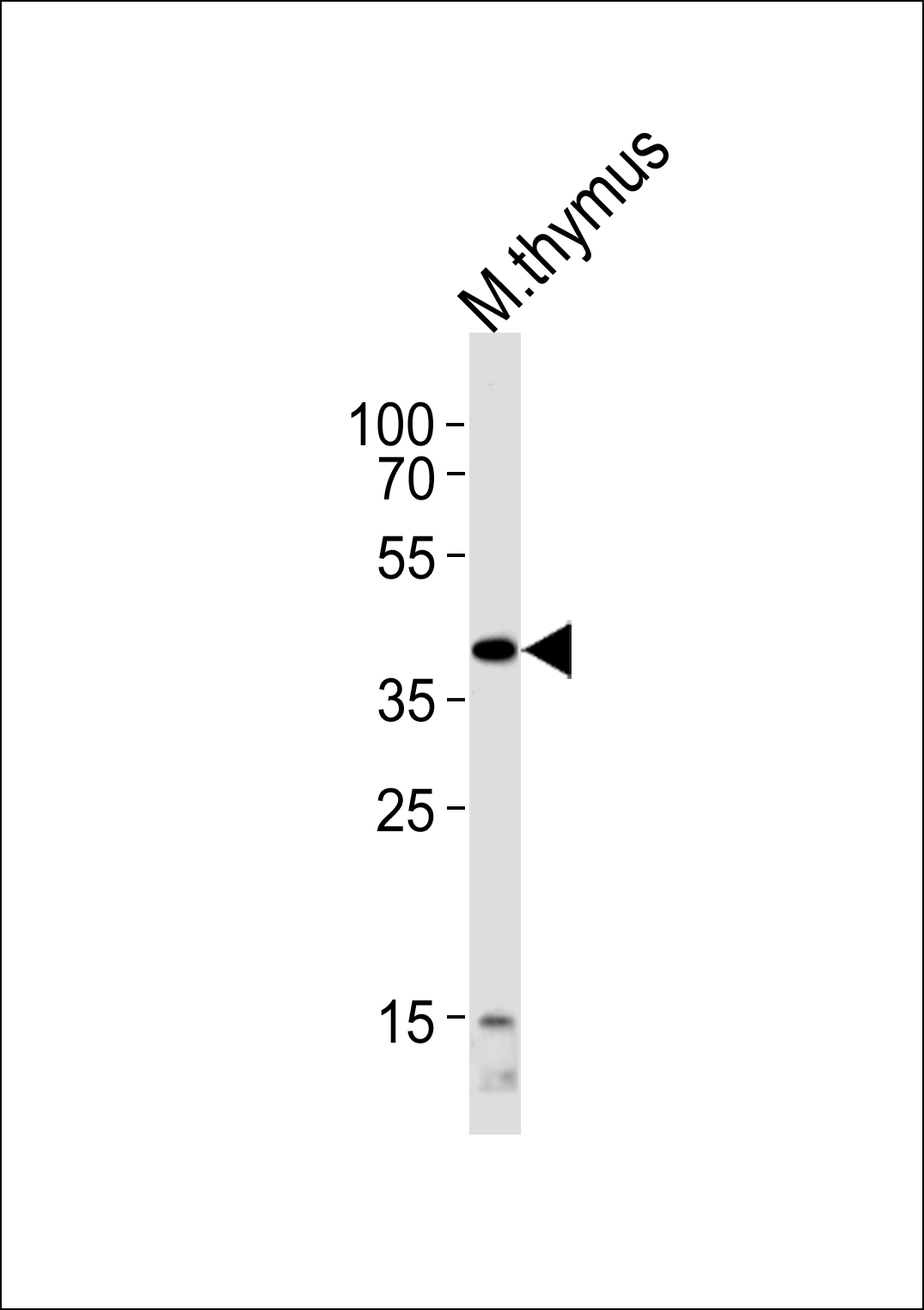 Rabbit Polyclonal Antibody to Mouse Tfap2a