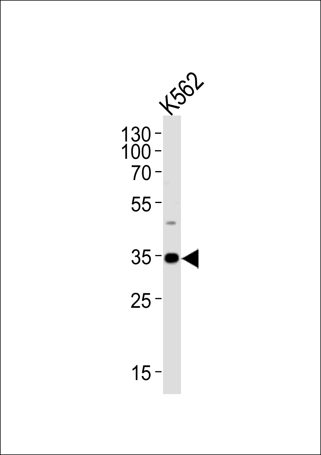 Rabbit Polyclonal Antibody to BBS5