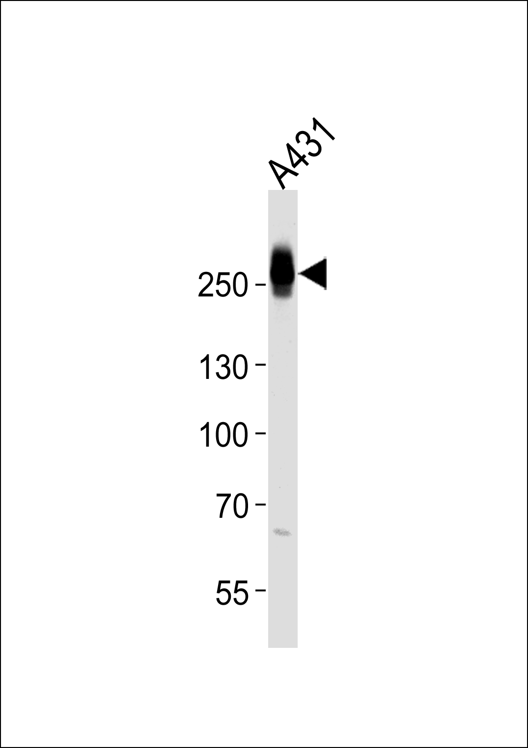 Rabbit Polyclonal Antibody to MYH14